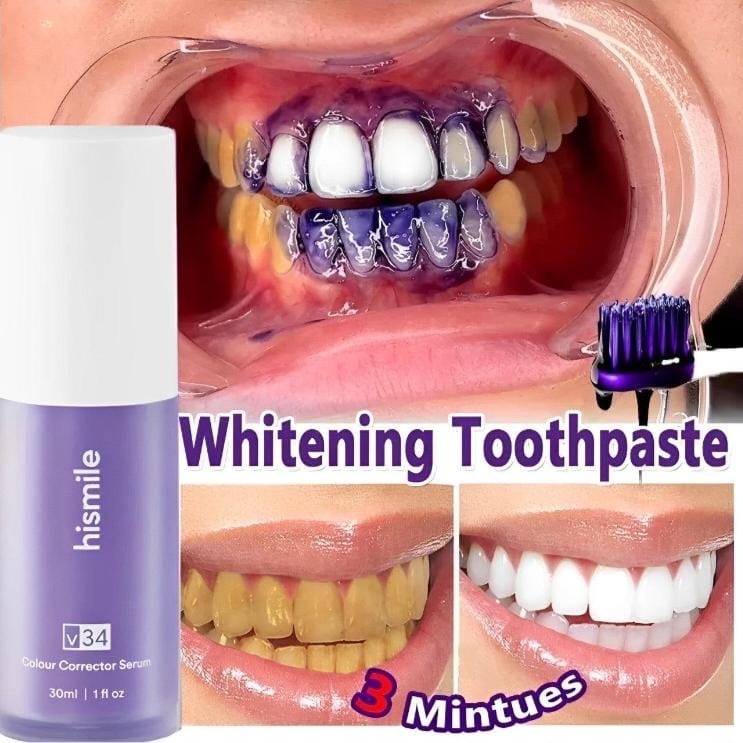 Hismile Teeth whitening
